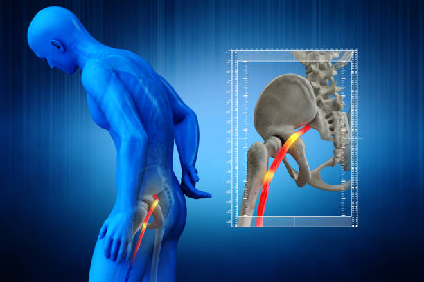 Long Covid & Its Disabling Effects On Hip Joints: Expert Explains