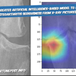 IIT Guwahati Creates Artificial Intelligence-based Model To Predict Knee Osteoarthritis Seriousness From X-ray Pictures